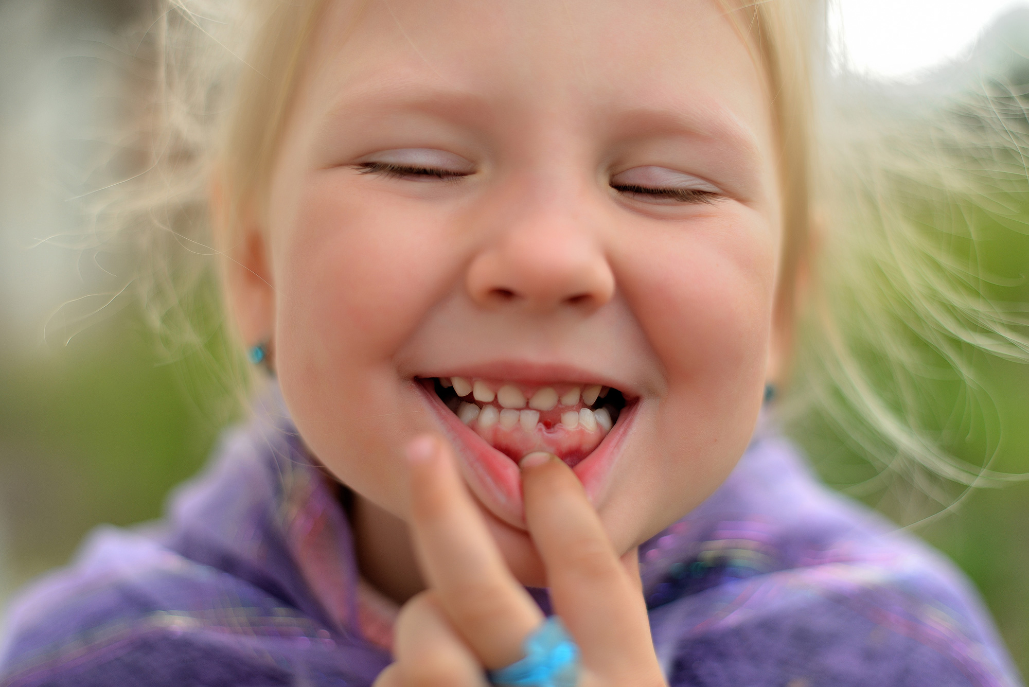 Portrait: Smiling little girl without one tooth