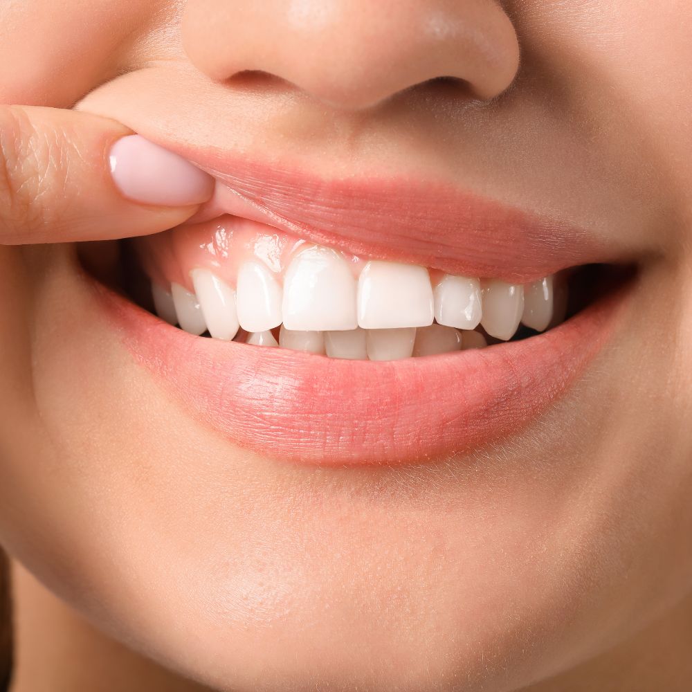 close up of woman's smile showing healthy gums and teeth